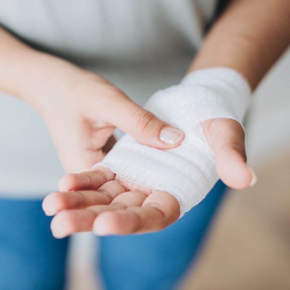 Medidas preventivas en invierno: cómo reducir el riesgo de quemaduras en el hogar