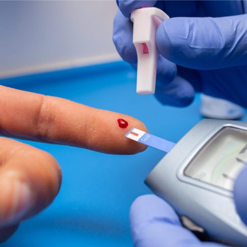 Epidemia oculta: la propagación de la diabetes tipo 2 a nivel global