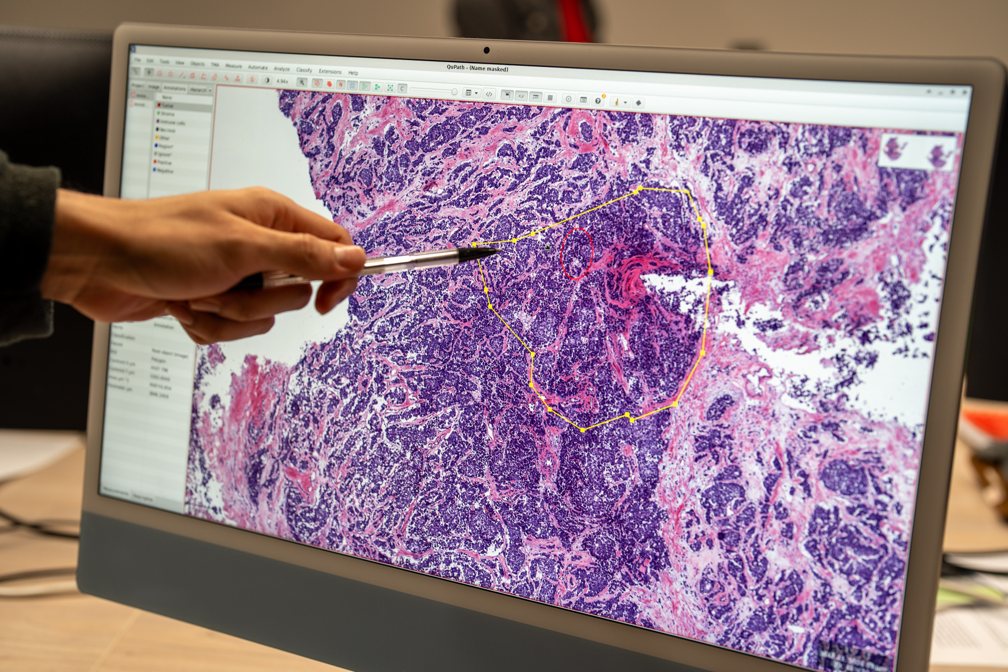 Supercomputación aplicada a la salud pública