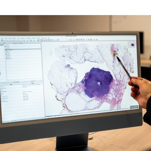 Región de O’Higgins da un salto hacia la medicina de precisión con supercomputación aplicada a la salud pública