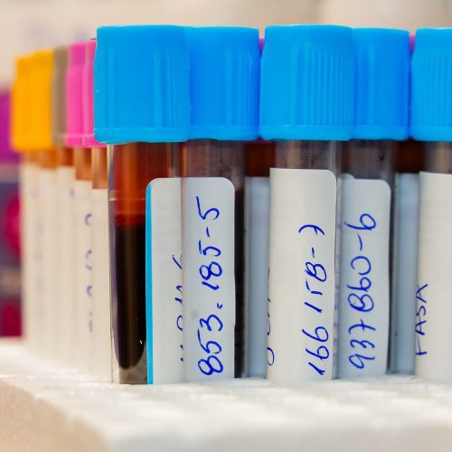 La hepatitis también se previene en la UOH: educación para el autocuidado