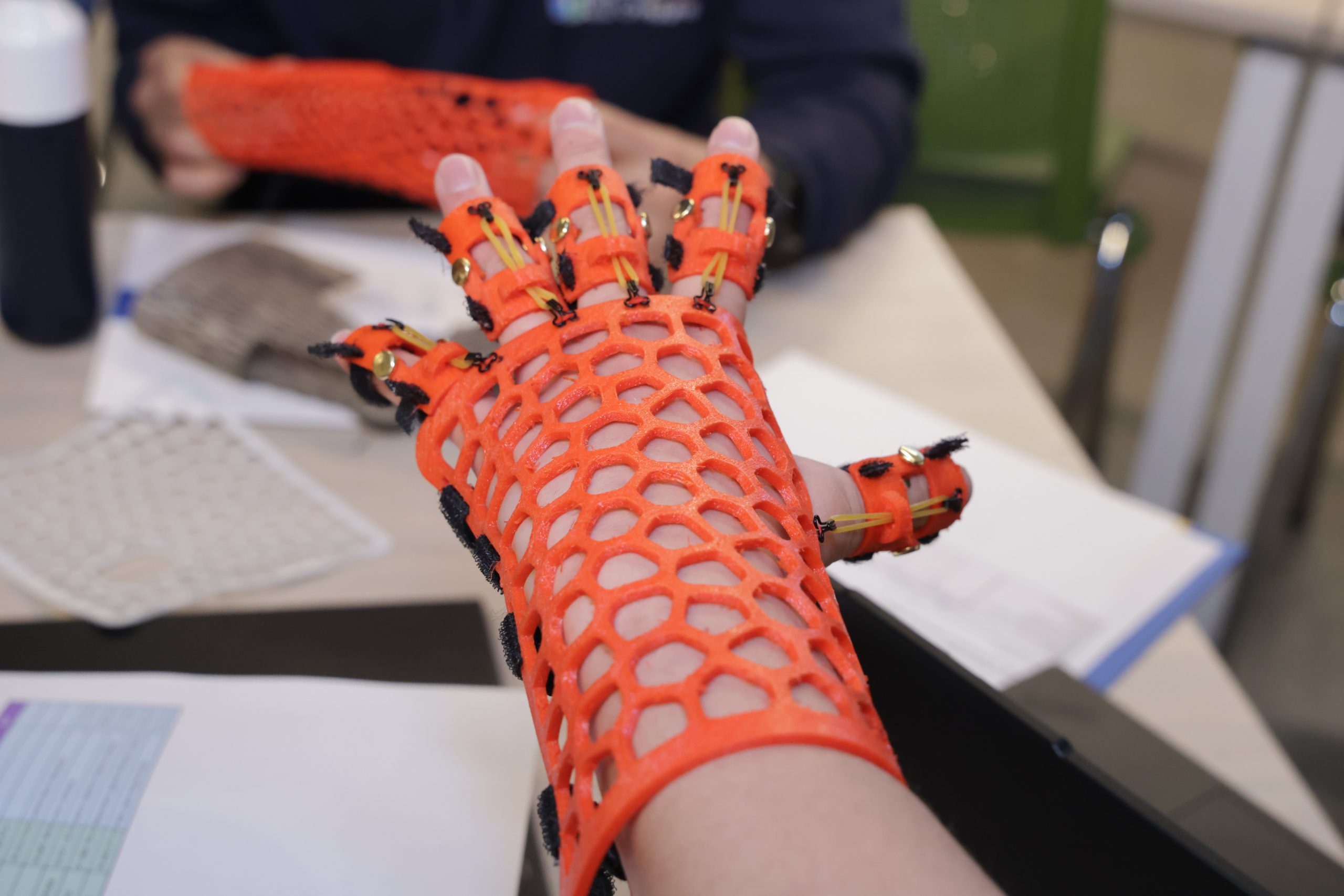 Terapeutas ocupacionales ganaron concurso “Desafío de innovación y fabricación digital” que organizó la UOH